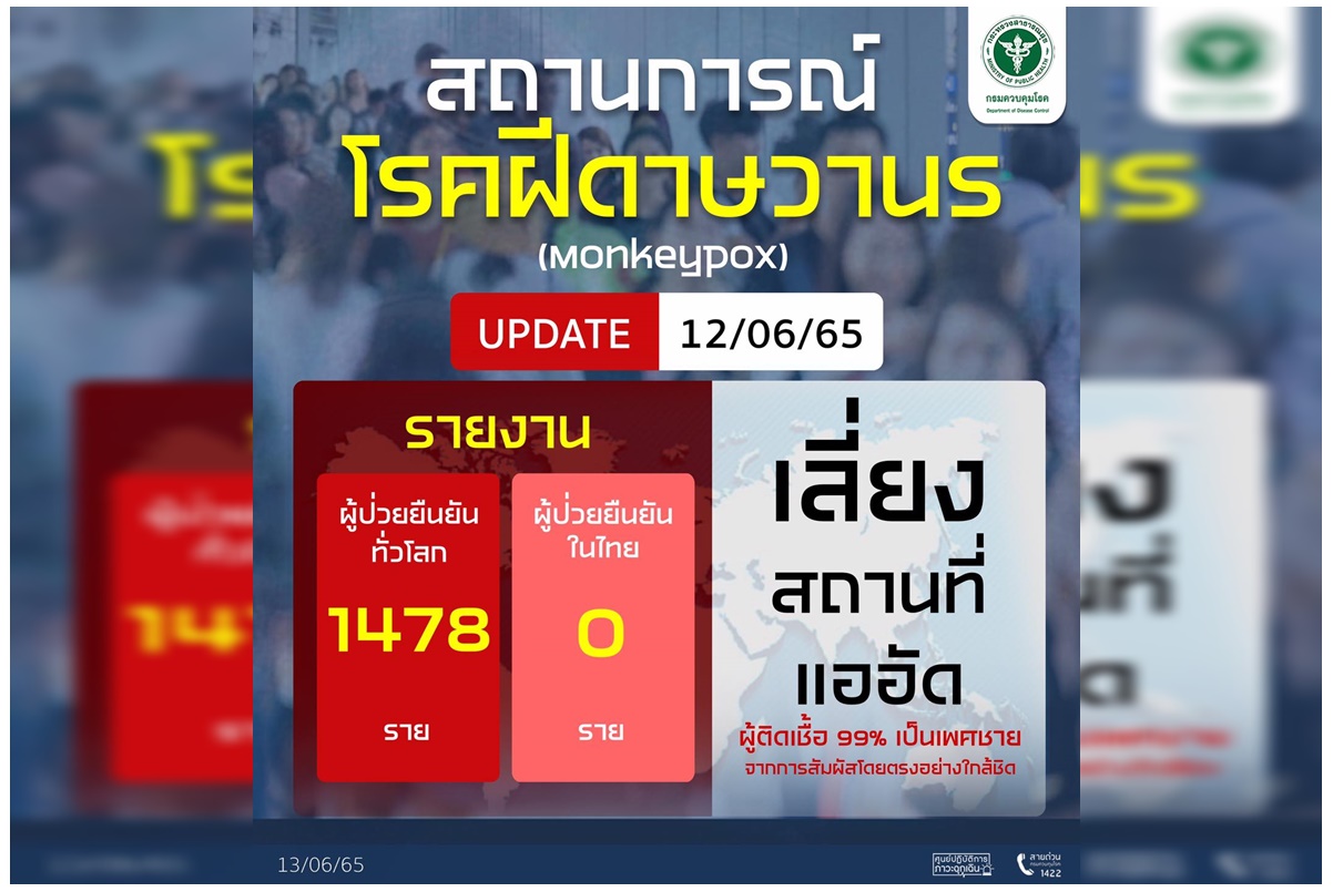 ไทยยังไม่พบ! "ฝีดาษวานร" ป่วยทั่วโลก 1,478 ราย 