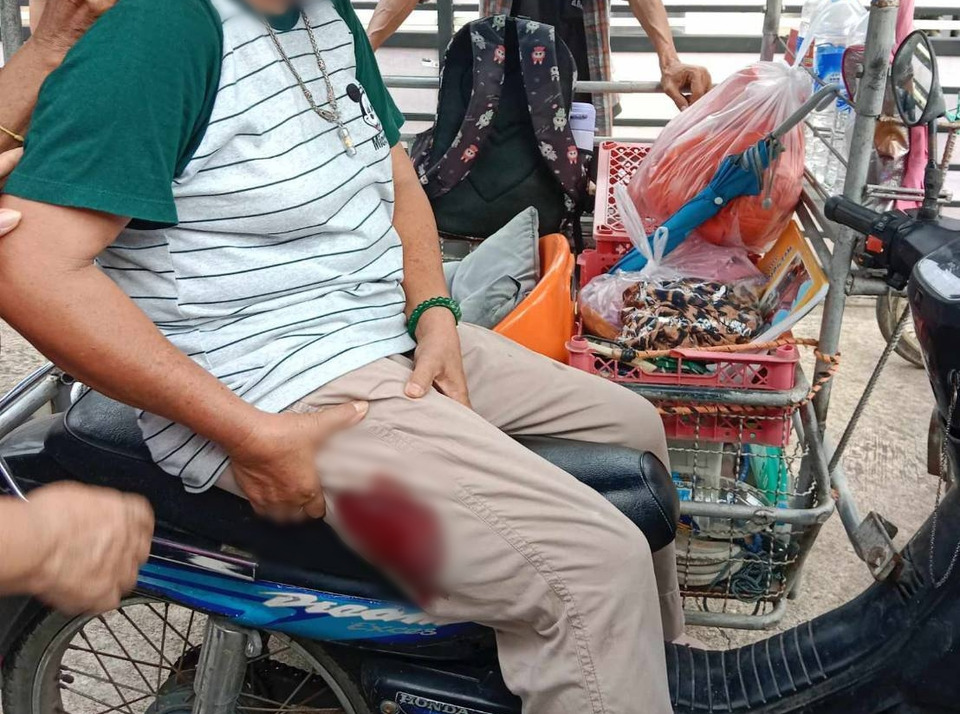 ช็อก! ป้าวัย 61 ขับซาเล้งถูก "กระสุนปริศนา" เจาะขา! ที่แท้เป็นฝีมือมือปืนยิงกระรอกพลาดเป้า!