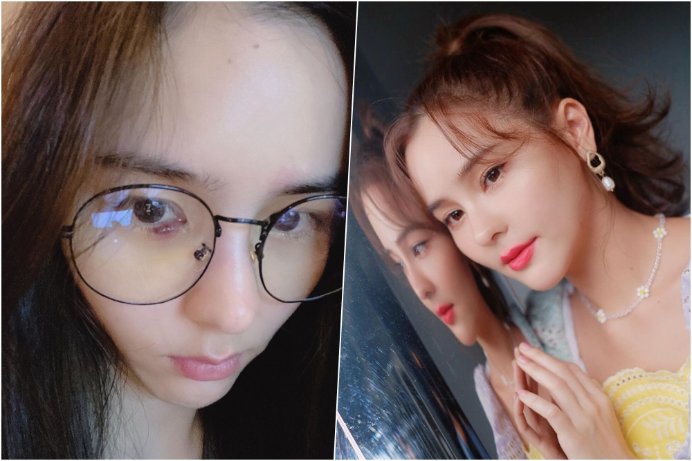 'ออม สุชาร์' ตาอักเสบ โพสต์เตือนภัยสาวๆ