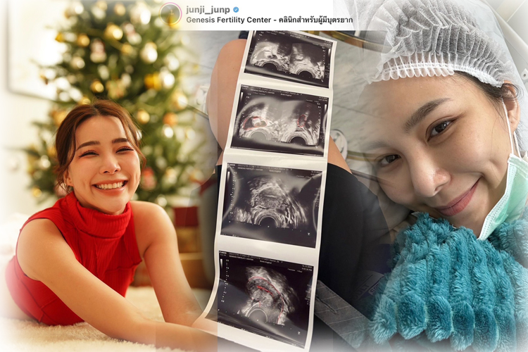 มองการณ์ไกล !!! จันจิ  รีวิวขั้นตอน ฝากไข่ กับ GFC เพื่อใช้ชีวิต-ทำงานได้อย่างเต็มที่ไร้ความกังวล