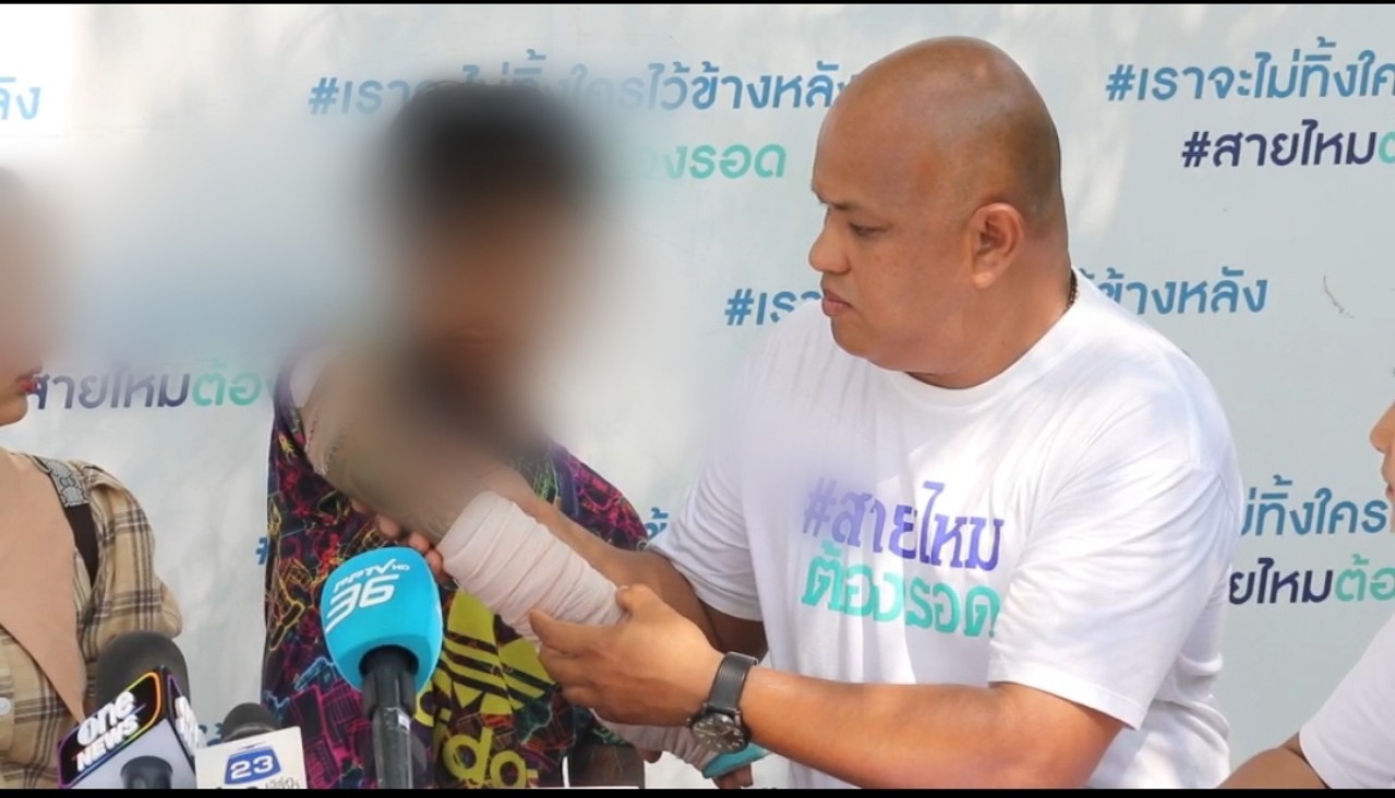 หนุ่มร้องสายไหมต้องรอด ถูกญาติเมายาใช้อาวุธมีดฟัน บาดเจ็บสาหัส เย็บกว่า 200 เข็ม 