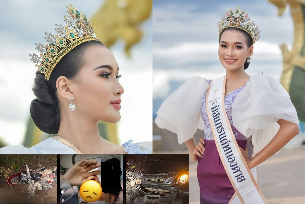 สาหัส! "อาร์กี้ มิสแกรนด์หนองคาย 2020" รถชนประสานงาขาหัก 3 ท่อน