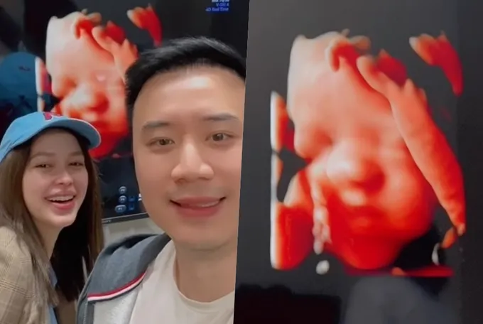 "แพทริเซีย-โน้ต" อวดภาพอัลตร้าซาวด์ลูกสาวแก้มยุ้ยละลายใจ