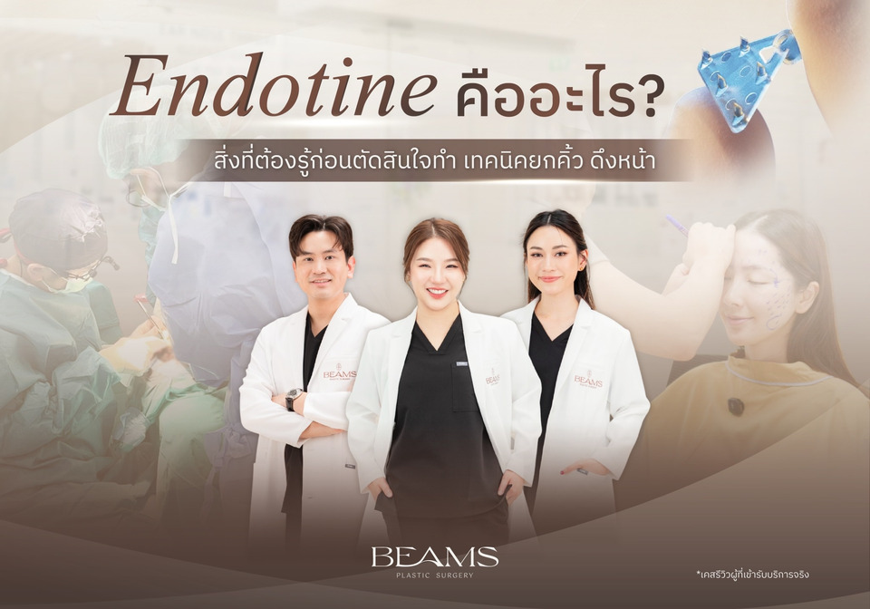 Endotine คืออะไร? รวมสิ่งที่ควรรู้ก่อนตัดสินใจทำยกคิ้ว ดึงหน้า
