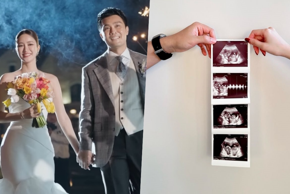 "พริม พริมา" โชว์ภาพอัลตราซาวด์ประกาศข่าวดีเบบี๋มาแล้ว