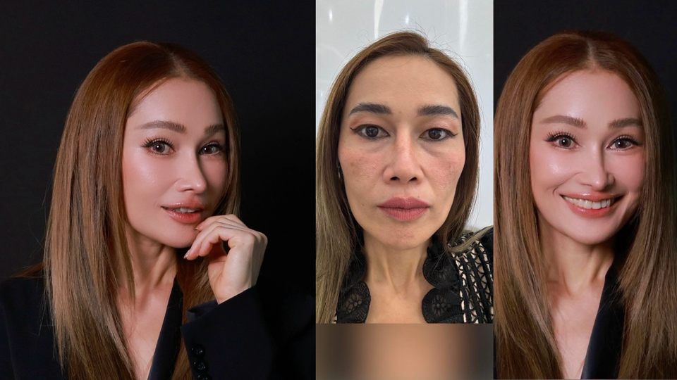 “คุณเปิ้ล” แม่ลูกสองวัย 48 ปี ผู้คว้าชัยชนะ Surgery Wars EP.3 กับการ Make Over ใบหน้า ผสาน 3 เทคนิคศัลยกรรมเฉพาะทาง