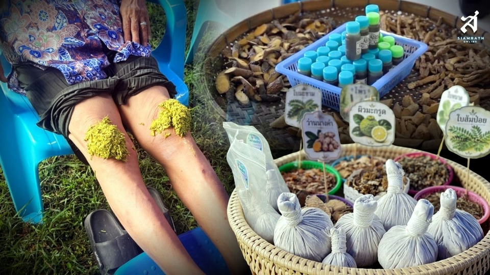 “เตาปูนโมเดล” เกมรุกสู้ NCDs ใช้ข้อมูล-นวัตกรรม “ดอกไม้ 3 สี” สร้างสุขภาวะชุมชนยั่งยืน