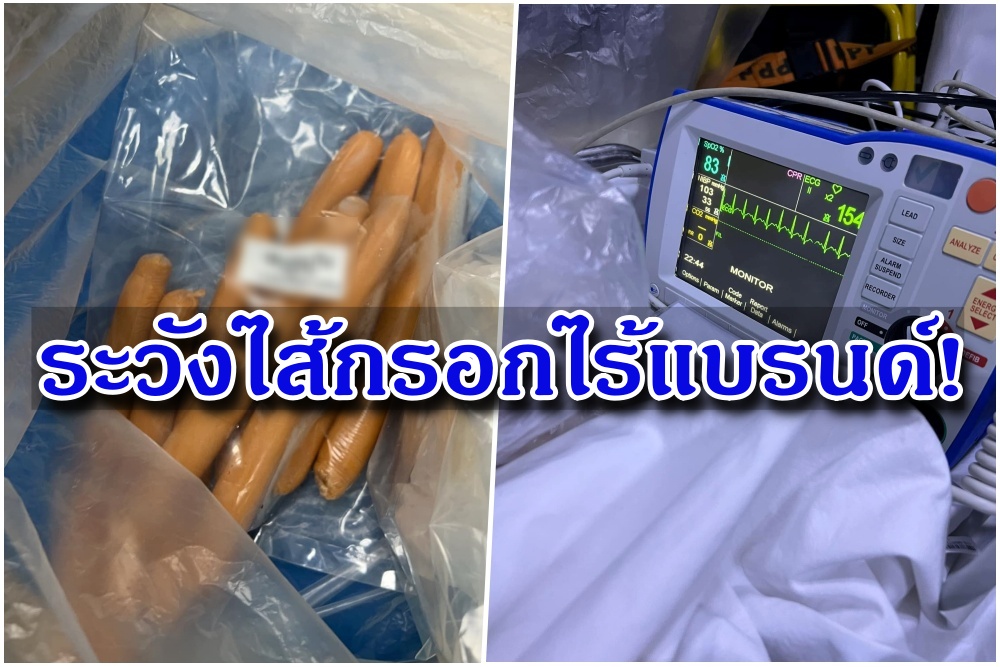 ระวัง! ไส้กรอกไร้แบรนด์ พบเด็กป่วยภาวะ 'เมทฮีโมโกลบิน' แล้ว 5 จว.