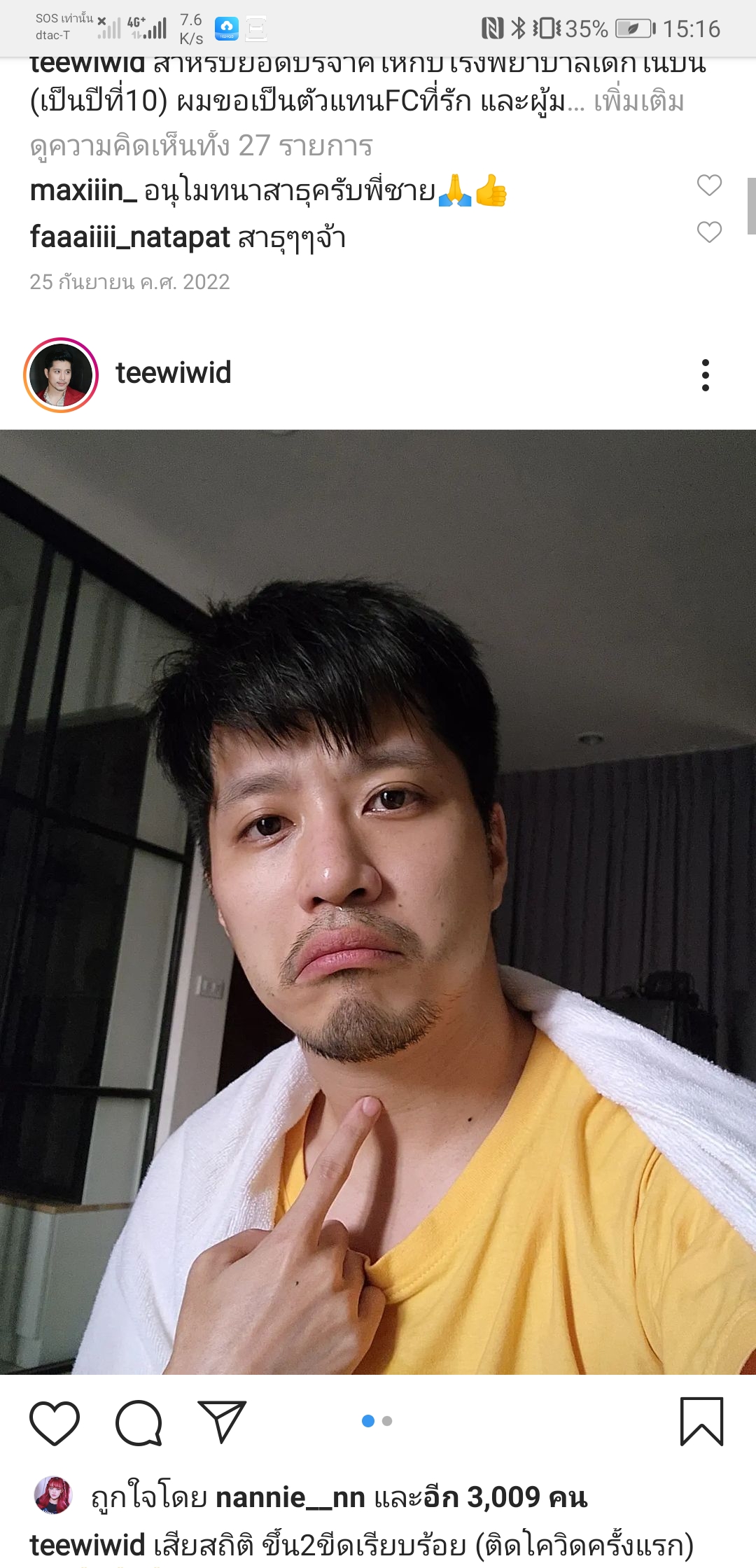 เสียสถิติ​ ขึ้น​2 ขีดจนได้​ "ตี๋ วิวิศน์ บวรกีรติขจร"ไม่รอดติดโควิด