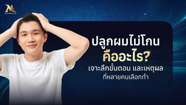 ปลูกผมไม่โกนคืออะไร? เจาะลึกขั้นตอน และเหตุผลที่หลายคนเลือกทำ 