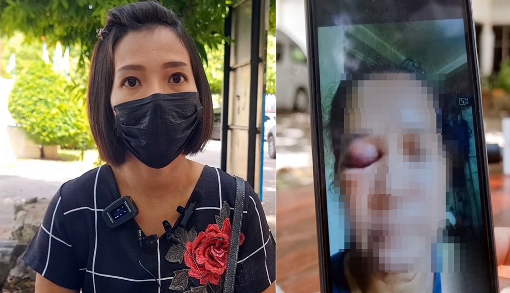 ลูกสาวร้องสื่อ แม่ถูกรุมทำร้าย ปมแอบจำนำทอง 6 หมื่น แต่ยังไม่ใช้เงินคืน