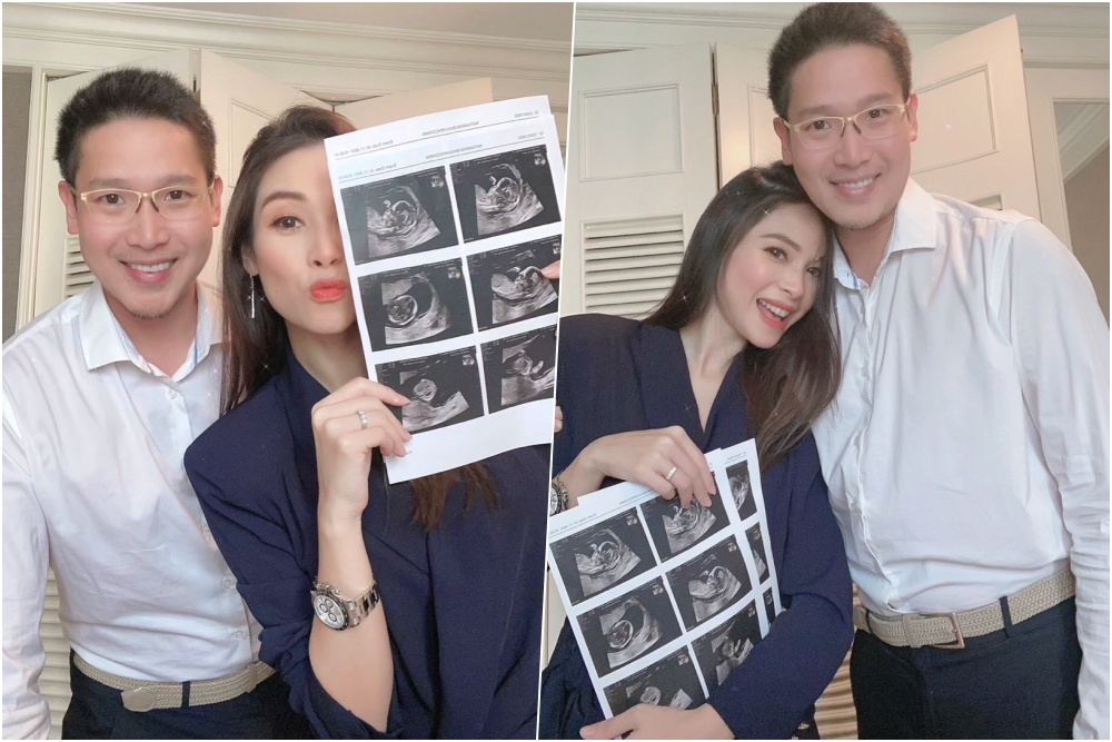 ว่าที่คุณแม่มือใหม่! 'ปอ ณฐมน' ประกาศท้องแล้วจ้า