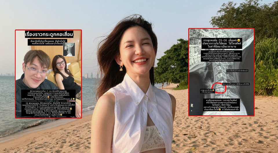 "ดาว ณัฐภัสสร" แชร์ประสบการณ์กระดูกคอเสื่อม เตือนออฟฟิศซินโดรม ภัยเงียบจากการก้มหน้าติดจอ
