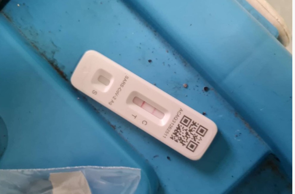 สธ.รออีก2อาทิตย์​ ยังไม่สรุปหนุ่มเมียนมาเสียชีวิตเพราะโควิดสายพันธุ์ผสม