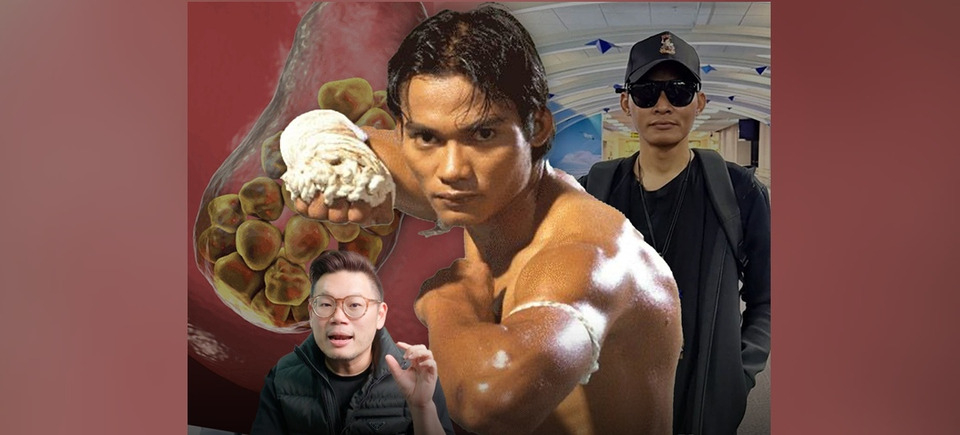 "หมอเจด" เผย 4 สัญญาณไม่ควรมองข้าม เสี่ยง "มะเร็งในถุงน้ำดี"