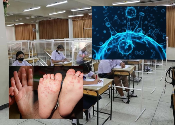 สธ.ห่วงเปิดเทอมต้องระวัง!คูณสอง ทั้งโควิด- มือเท้าปาก