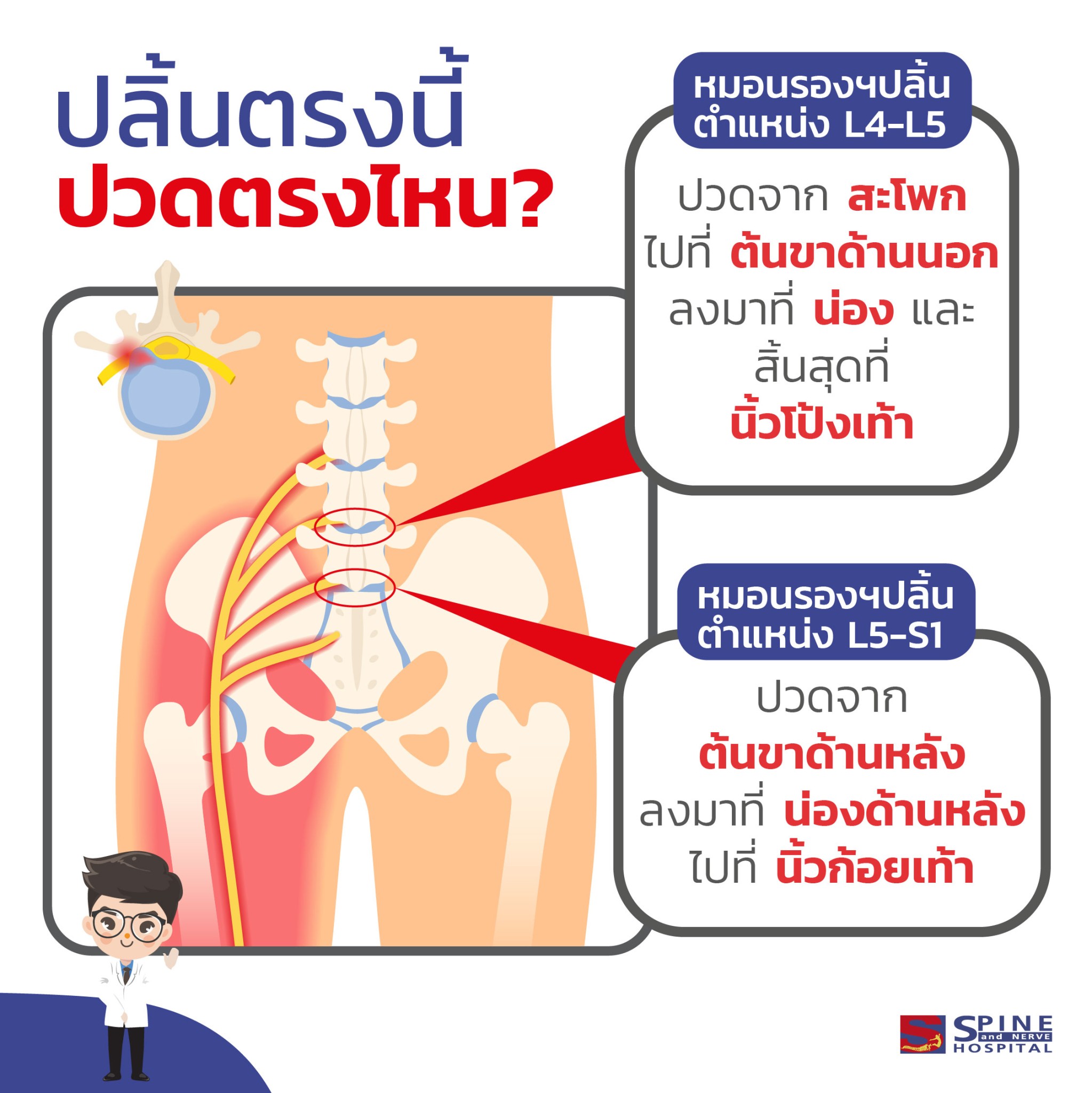 ทำความรู้จัก! ตำแหน่งปลิ้นหมอนรองกระดูกส่วนเอว...ทันโรคเพื่อทันการรักษา 