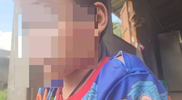 แม่ใจสลาย! ครูใช้ฟุตเหล็กฟาด-ตบ เด็ก7ขวบ หลังหยิบขนมกินเพราะไม่มีเงิน