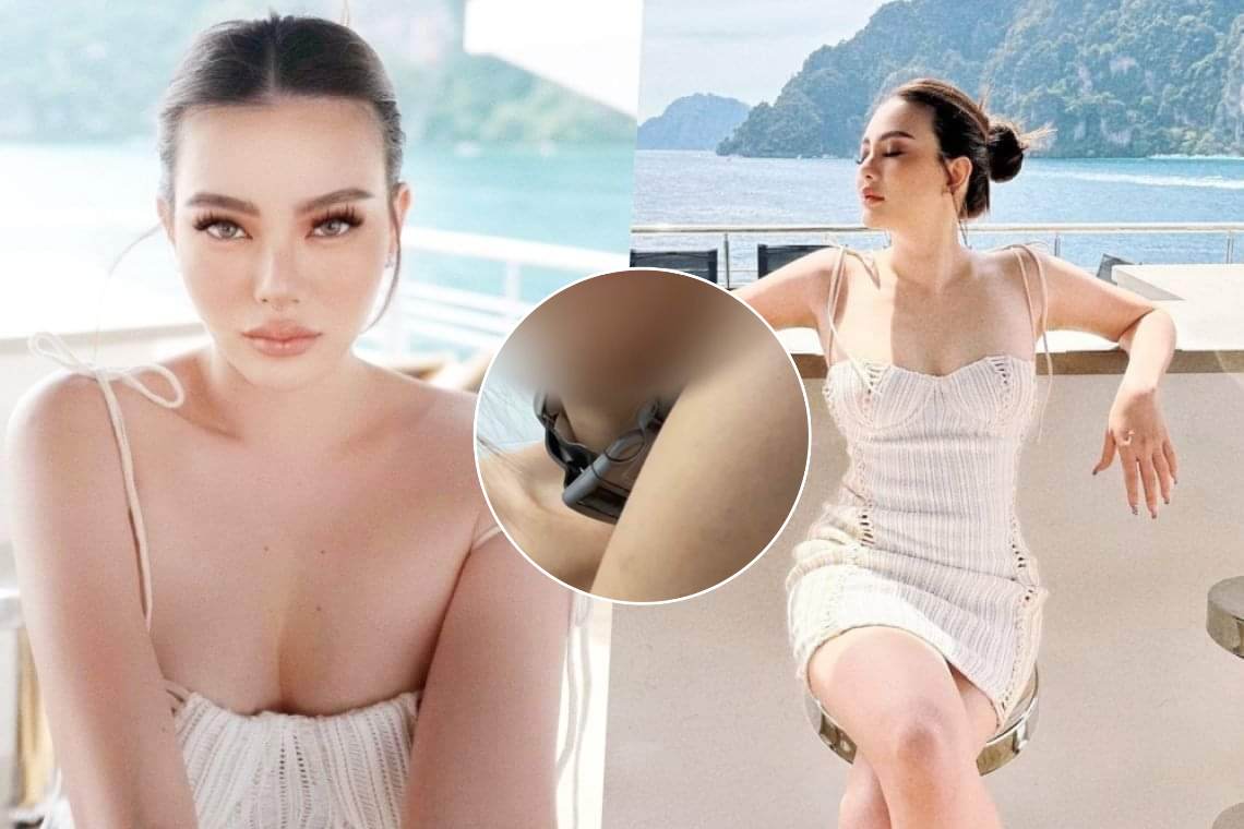 ชาวเน็ตสงสัย! "ดิว อริสรา" ปล่อยภาพถูกทำร้าย ซูมที่คอคล้ายเครื่องฝึกสุนัข