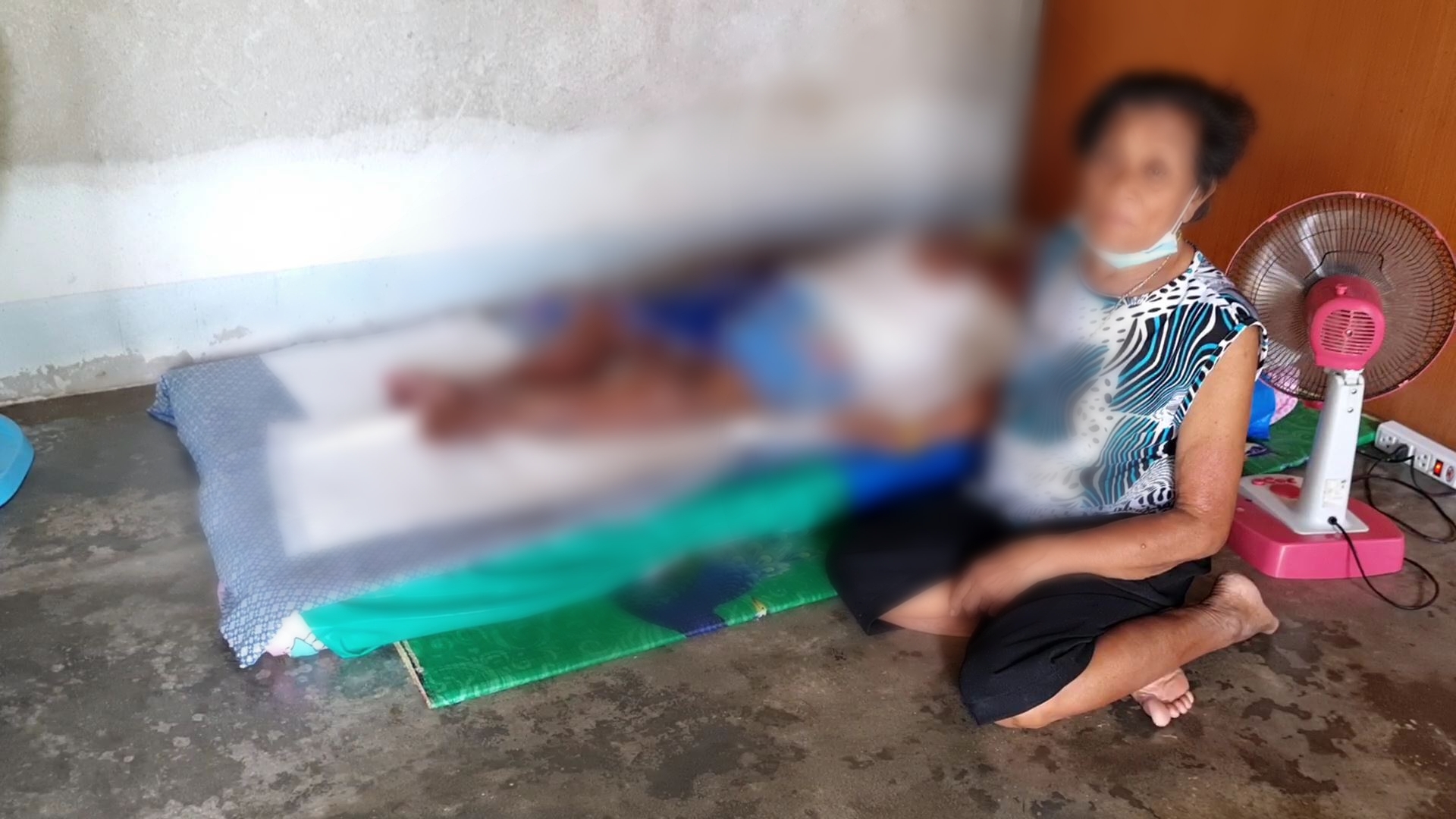 พบหญิงป่วยโรคประหลาดเป็นแผลเปื่อยทั้งร่างหมอระบุพบรายแรกวอนขอช่วย