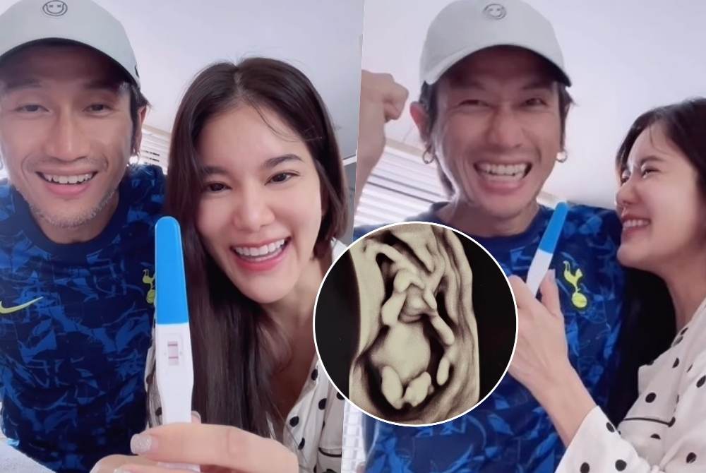  "ตูน บอดี้สแลม" โชว์ภาพอัลตราซาวด์ลูกคนที่ 2 แฟนคลับแห่ลุ้นเพศ