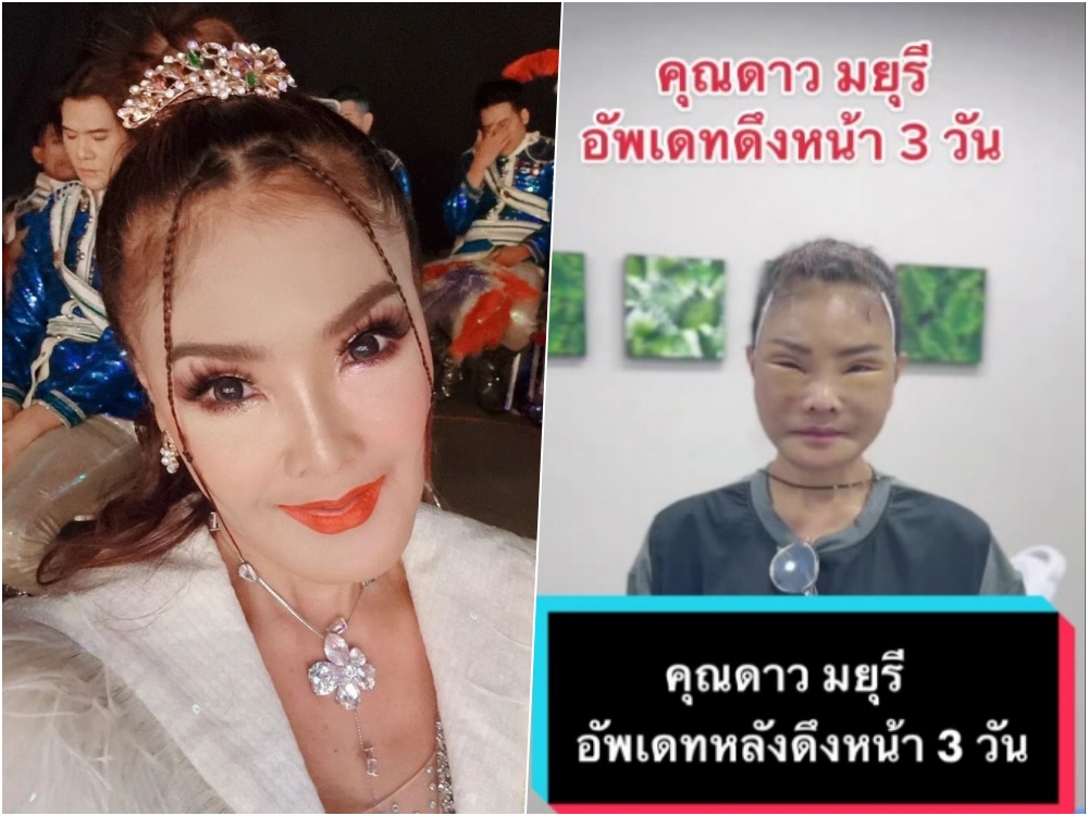 ฮือฮาเป็นอย่างมาก! "ดาว มยุรี" ขึ้นเขียงอัพหน้าใหม่อีกครั้ง FC แห่รอชม