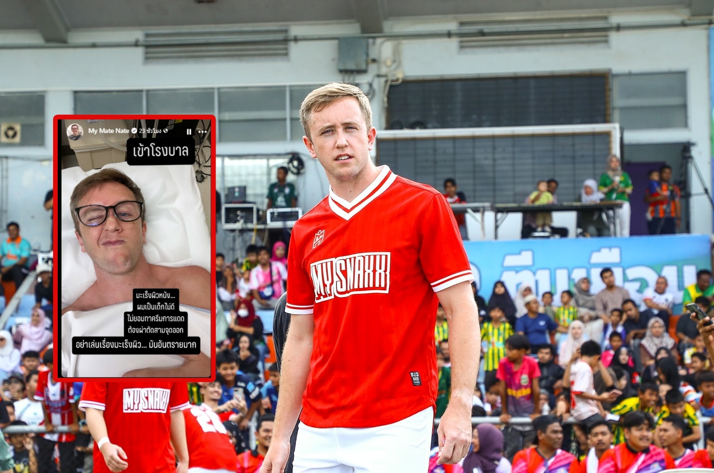 ช็อก! "เนท My Mate Nate" พบมะเร็งผิวหนัง เตือนแฟนคลับอย่าประมาทแดด