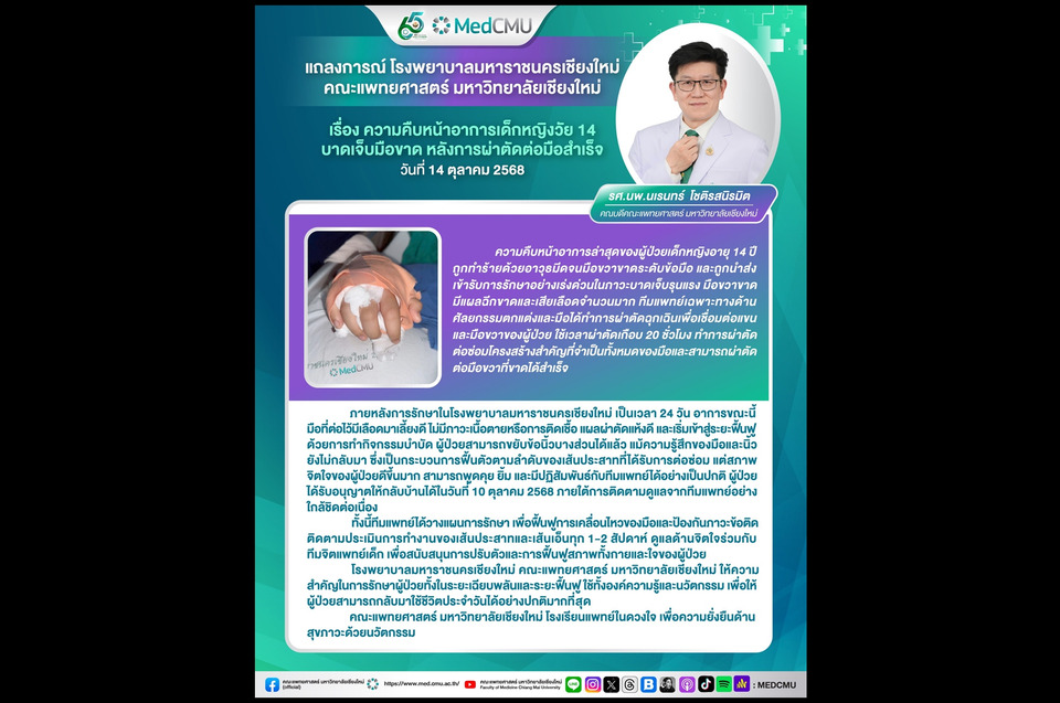 อัศจรรย์แพทย์ไทย! เด็กหญิง 14 มือขาด "หมอ รพ.มหาราชนครเชียงใหม่" ผ่าตัดต่อสำเร็จ ฟื้นตัวดี ขยับนิ้วได้แล้ว