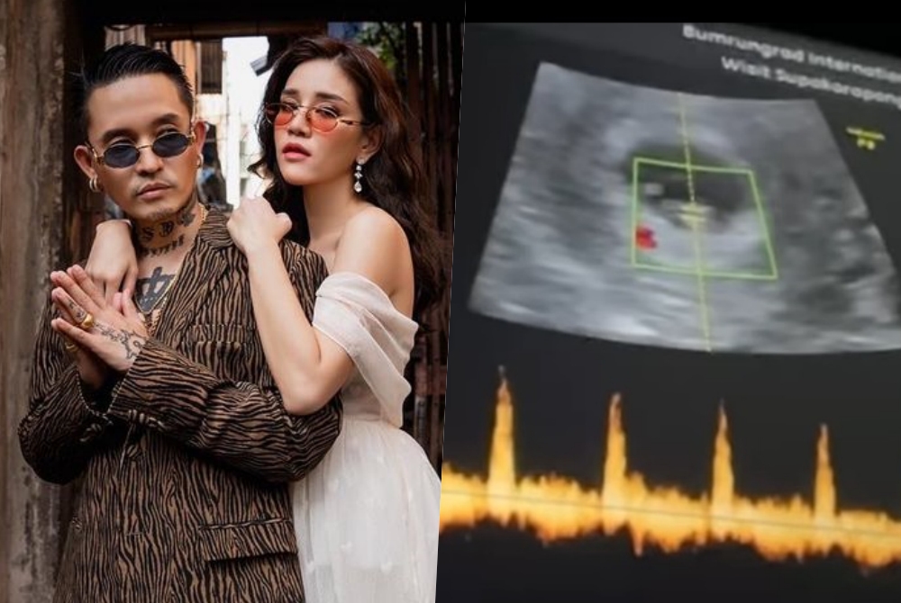 “เดย์ ไทยเทเนี่ยม” แจ้งข่าวเป็นว่าที่คุณพ่อรับอายุ 46 โชว์ภาพอัลตราซาวด์ภรรยา