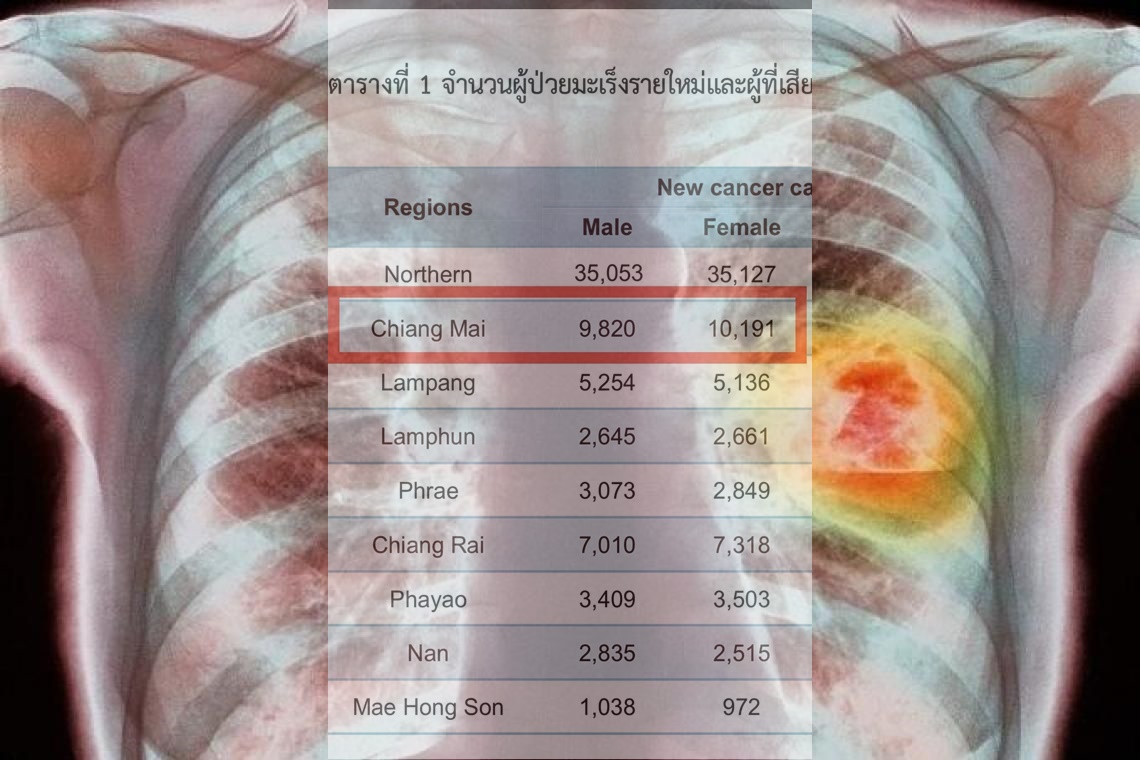 น่ากลัว! เชียงใหม่ 'ป่วยมะเร็งปอด' ติดอันดับหนึ่ง PM 2.5 ตัวจุดชนวน