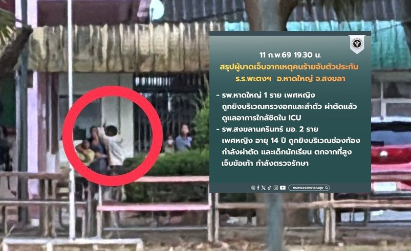 สธ.เผยเหตุบุกยิง รร.พะตงฯ  ผอ.อยู่ไอซียู - นร.ถูกยิงท้องกำลังผ่าตัด 