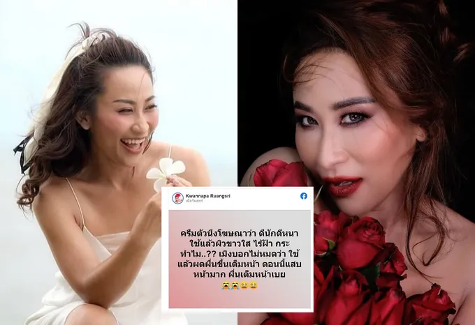 'ลาล่า'  ซัดกลับสินค้าโฆษณาเกินจริงใช้แล้วผื่นขึ้นเต็มหน้า