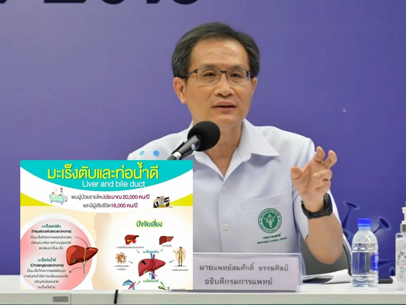 มะเร็งท่อน้ำดี ภัยเงียบ!คร่าชีวิตคนไทย 