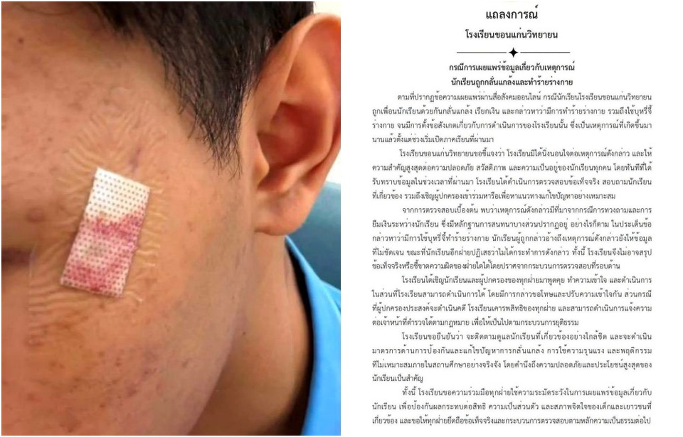 ดราม่า ม.6 ขอนแก่น! โรงเรียนออกแถลงการณ์ ปมโดนบูลลี่-บุหรี่จี้ ชี้เบื้องต้นแค่ทวงเงิน ยันพร้อมให้ตำรวจสอบ