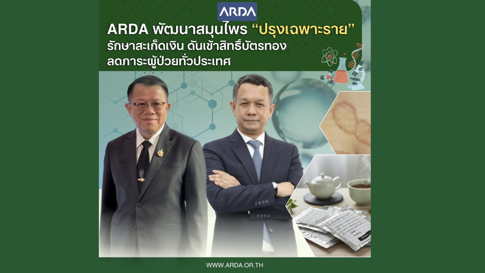 ARDA พัฒนายาสมุนไพร “ปรุงเฉพาะราย” รักษาโรคสะเก็ดเงิน   เดินหน้าดันเข้าสิทธิ์บัตรทอง ลดภาระผู้ป่วยทั่วประเทศ