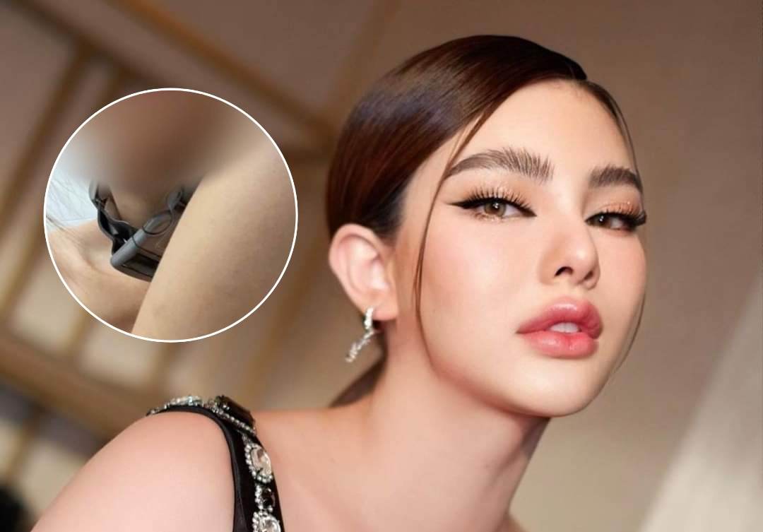 “ดิว อริสรา” ตอบแล้วภาพถูกทำร้ายที่ชาวเน็ตสงสัย ที่คอใช่ “ปลอกคอ” ฝึกสุนัขหรือไม่?