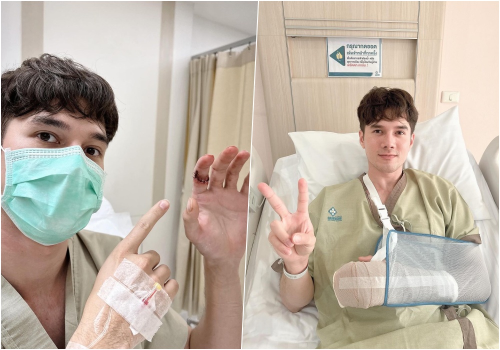 แห่ให้กำลังใจ "มิกค์ ทองระย้า" แอดมิตผ่าตัดด่วน เกิดอุบัติเหตุเส้นเอ็นนิ้วขาด 2 เส้น