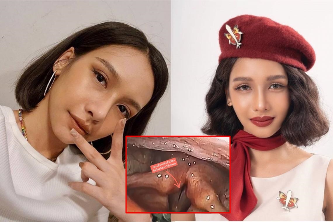 นักร้องสาว 'โบกี้ ไลอ้อน' อัพเดตอาการลองโควิด กล้ามเนื้อเส้นเสียงอ่อนแรง