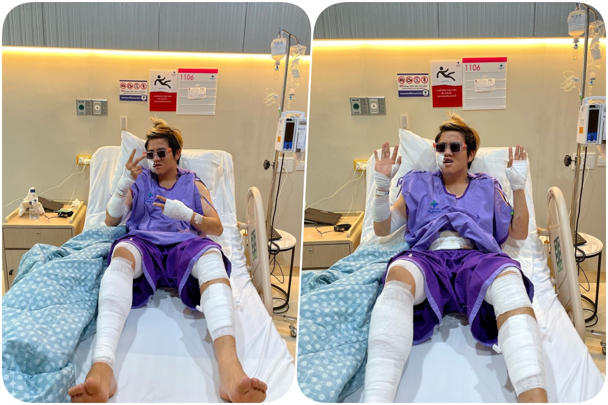 ขอบคุณทุกกำลังใจ!! "แบงค์ปิ" ยูทูปเบอร์ชื่อดัง โดนถังอากาศระเบิดใส่ โชว์แผลเต็มตัว